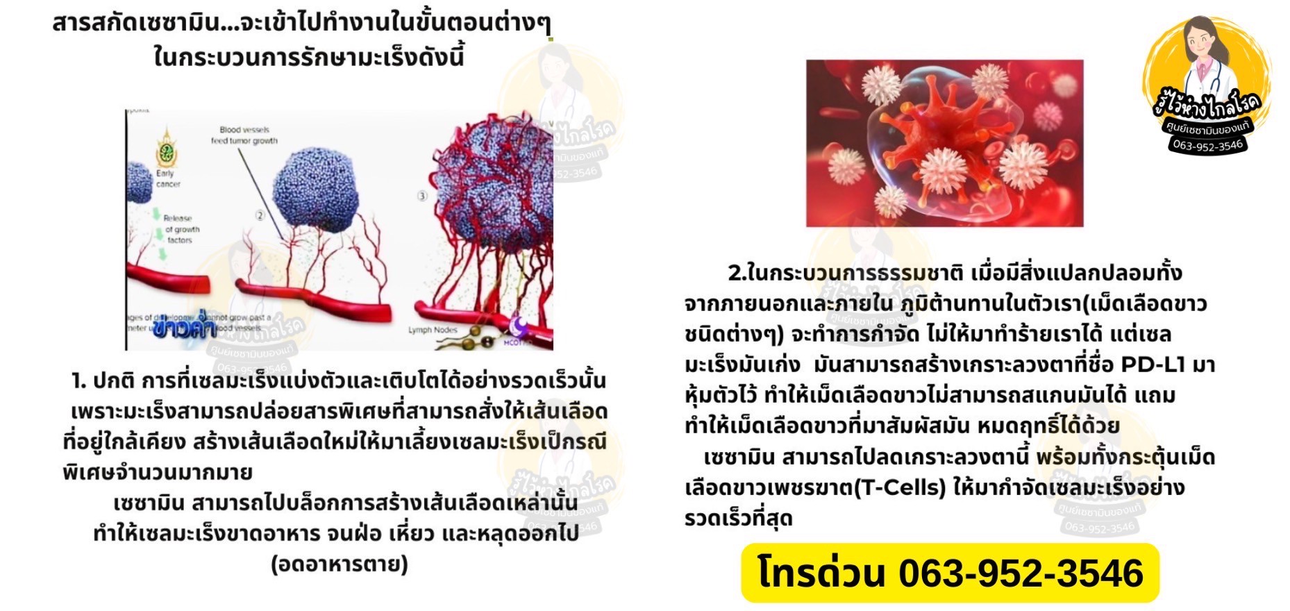 เซซามิน 9